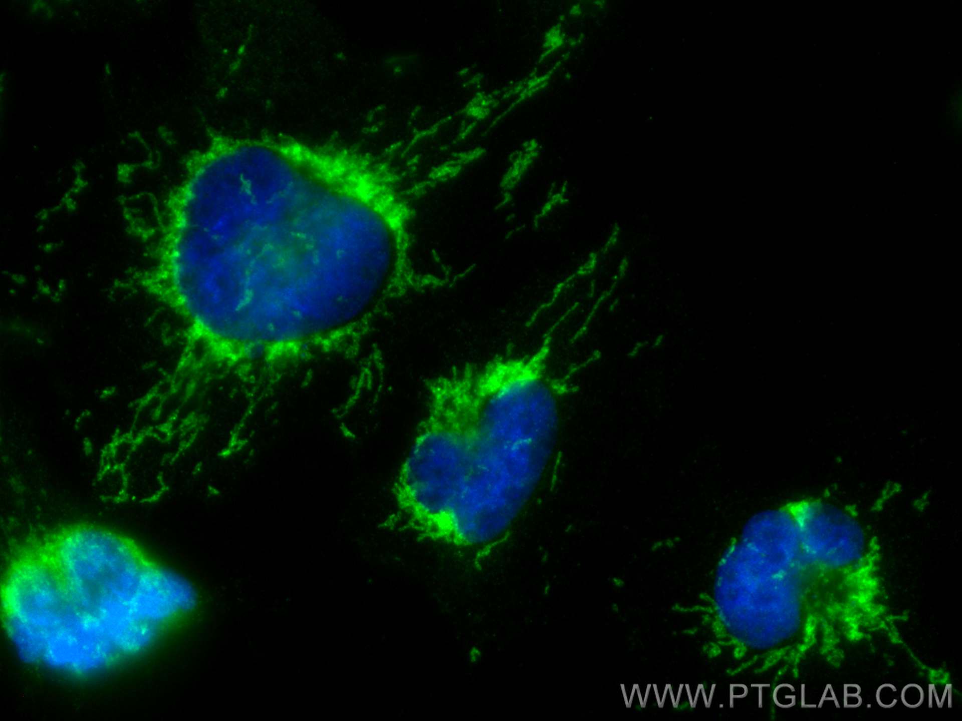 Immunofluorescence (IF) / fluorescent staining of U-251 cells using CoraLite® Plus 488-conjugated MTCH2 Polyclonal ant (CL488-16888)