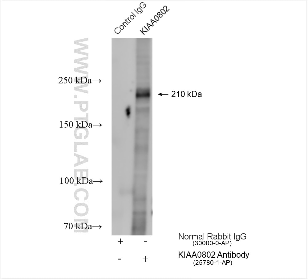 Immunoprecipitation (IP) experiment of A549 cells using MTCL1 Polyclonal antibody (25780-1-AP)