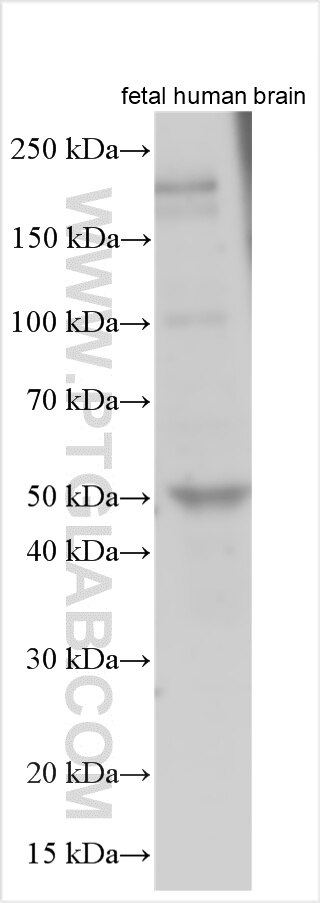 WB analysis using 33016-1-AP Western Blot (WB) analysis of various lysates using MTCL2 Polyclonal antibody (33016-1-AP)