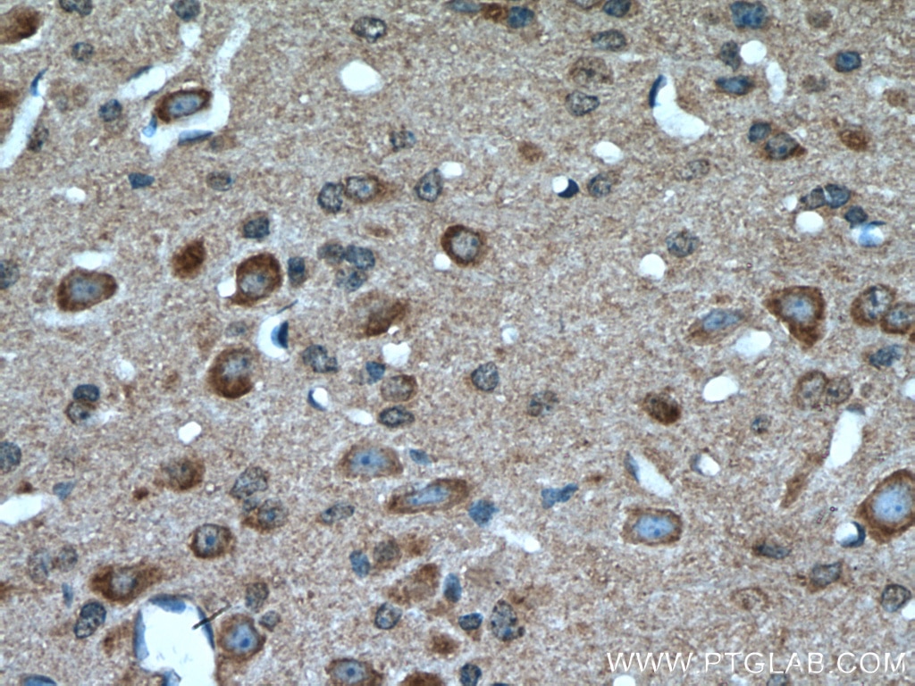 Immunohistochemistry (IHC) staining of mouse cerebellum tissue using MTCO3 Polyclonal antibody (55082-1-AP)
