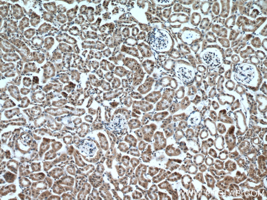 Immunohistochemistry (IHC) staining of mouse kidney tissue using MTCO3 Polyclonal antibody (55082-1-AP)