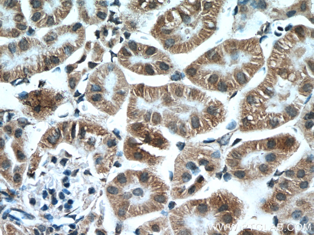 Immunohistochemistry (IHC) staining of mouse kidney tissue using MTCO3 Polyclonal antibody (55082-1-AP)