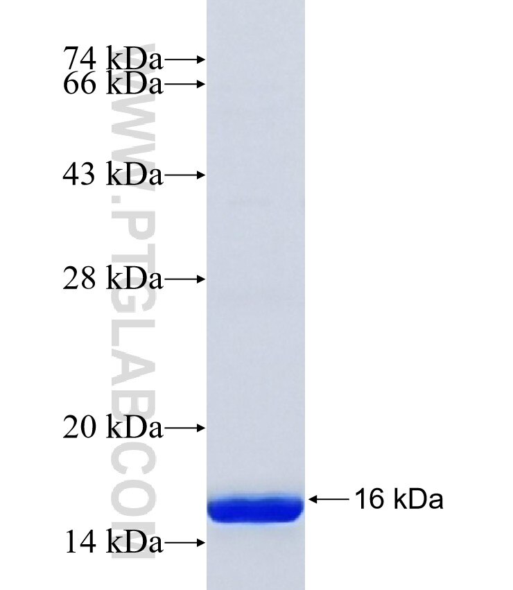 MTCP1 fusion protein Ag41544 SDS-PAGE MTCP1 fusion protein Ag41544 SDS-PAGE