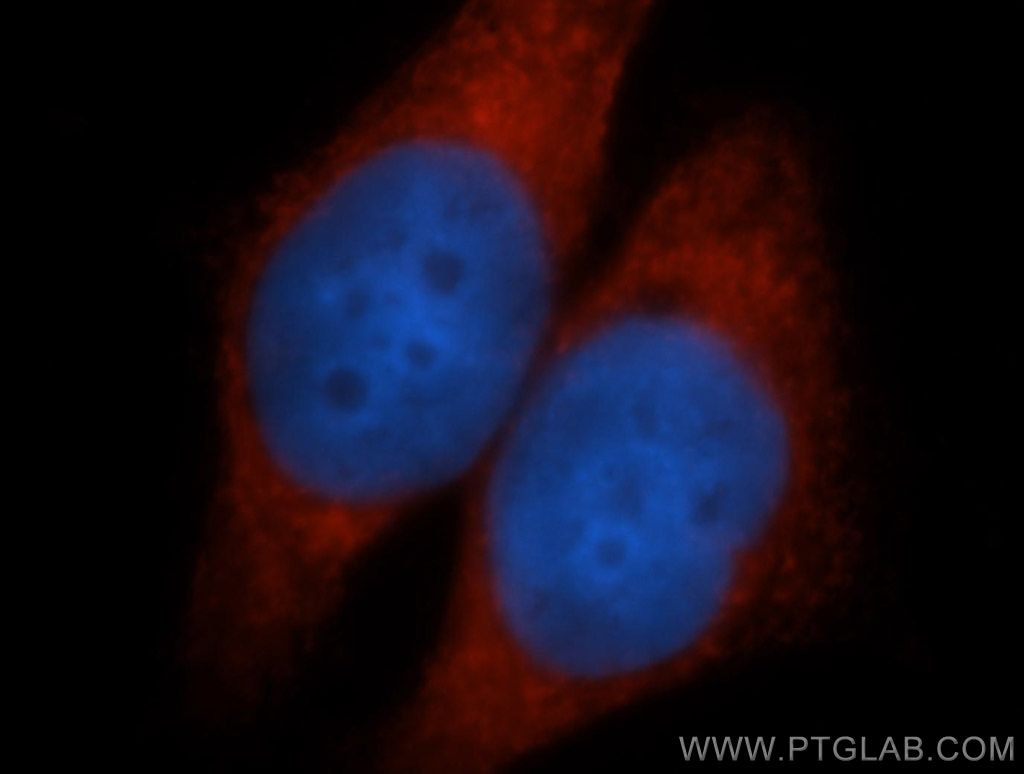 Immunofluorescence (IF) / fluorescent staining of MCF-7 cells using AEG-1/MTDH-Specific Polyclonal antibody (13860-1-AP)