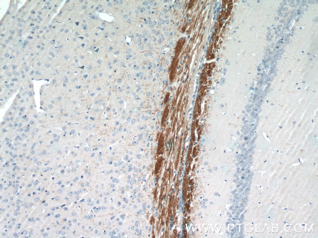 Immunohistochemistry (IHC) staining of mouse brain tissue using AEG-1/MTDH-Specific Polyclonal antibody (13860-1-AP)