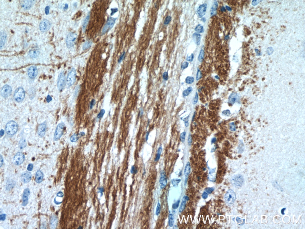 Immunohistochemistry (IHC) staining of mouse brain tissue using AEG-1/MTDH-Specific Polyclonal antibody (13860-1-AP)