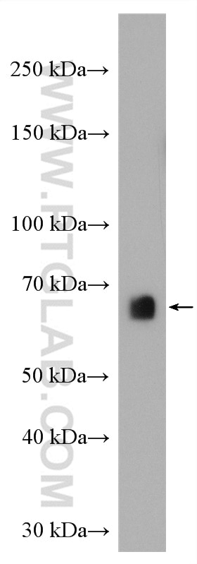 Western Blot (WB) analysis of mouse spleen tissue using AEG-1/MTDH-Specific Polyclonal antibody (13860-1-AP)
