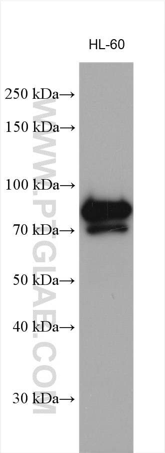 Western Blot (WB) analysis of various lysates using AEG-1/MTDH-Specific Polyclonal antibody (13860-1-AP)