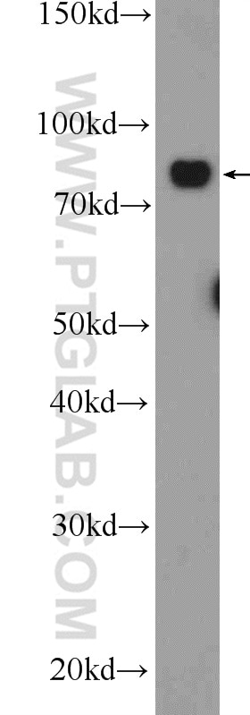 Western Blot (WB) analysis of RAW 264.7 cells using AEG-1/MTDH-Specific Polyclonal antibody (13860-1-AP)