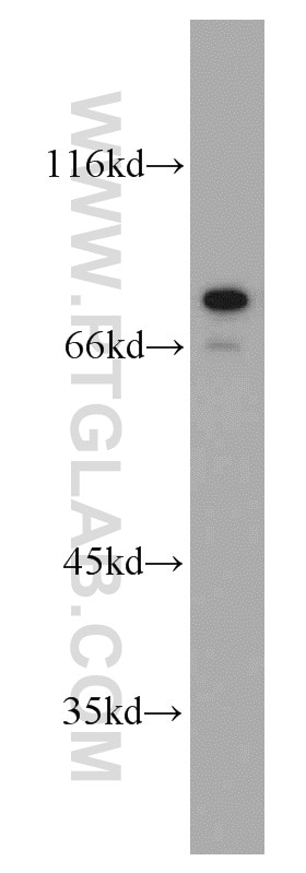 Western Blot (WB) analysis of HeLa cells using AEG-1/MTDH-Specific Polyclonal antibody (13860-1-AP)