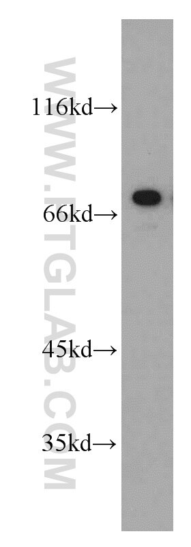 Western Blot (WB) analysis of A549 cells using AEG-1/MTDH-Specific Polyclonal antibody (13860-1-AP)