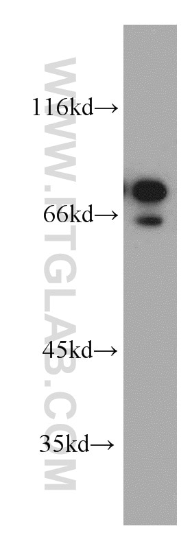 Western Blot (WB) analysis of DU 145 cells using AEG-1/MTDH-Specific Polyclonal antibody (13860-1-AP)