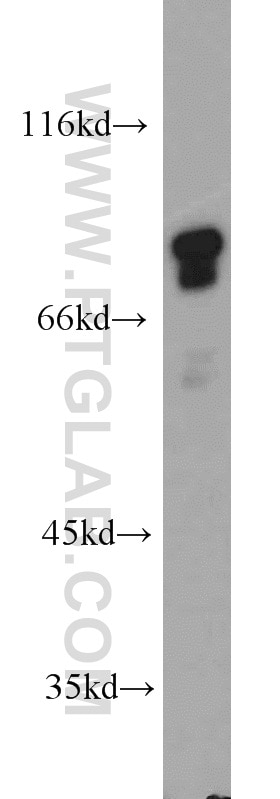 Western Blot (WB) analysis of A375 cells using AEG-1/MTDH-Specific Polyclonal antibody (13860-1-AP)