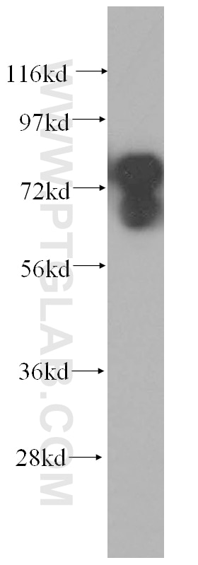 Western Blot (WB) analysis of PC-3 cells using AEG-1/MTDH-Specific Polyclonal antibody (13860-1-AP)