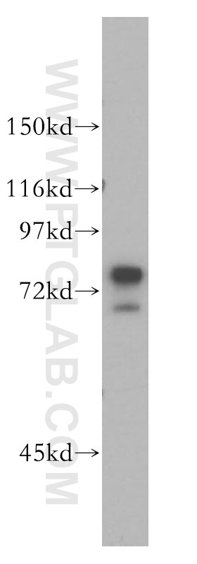 Western Blot (WB) analysis of HepG2 cells using AEG-1/MTDH-Specific Polyclonal antibody (13860-1-AP)