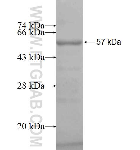 AEG-1 fusion protein Ag5033 SDS-PAGE