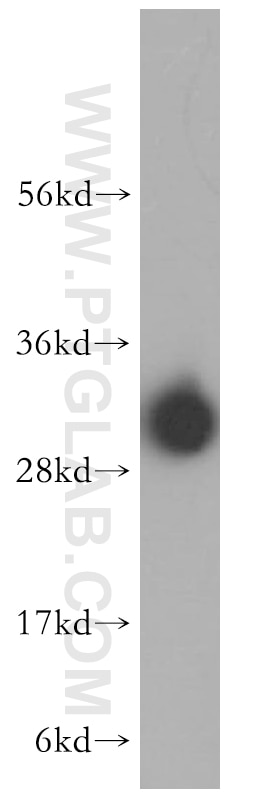 Western Blot (WB) analysis of HeLa cells using MTERF Polyclonal antibody (16957-1-AP)