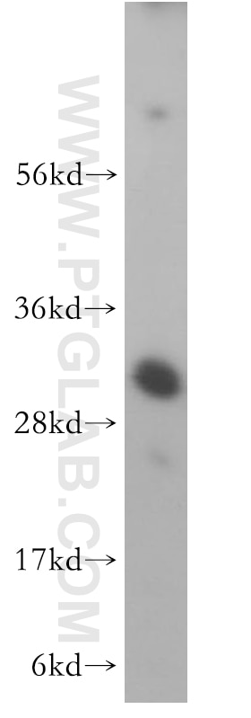 Western Blot (WB) analysis of Jurkat cells using MTERF Polyclonal antibody (16957-1-AP)