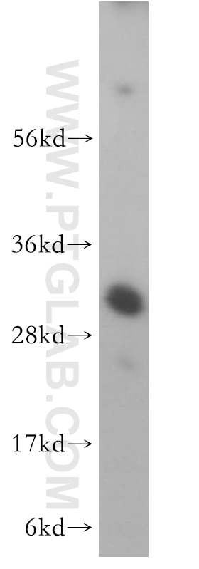 WB analysis of Jurkat using 16957-1-AP