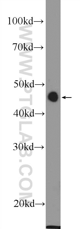 Western Blot (WB) analysis of mouse liver tissue using MTERFD1 Polyclonal antibody (23296-1-AP)