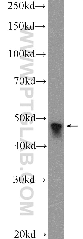 Western Blot (WB) analysis of HeLa cells using MTERFD1 Polyclonal antibody (23296-1-AP)