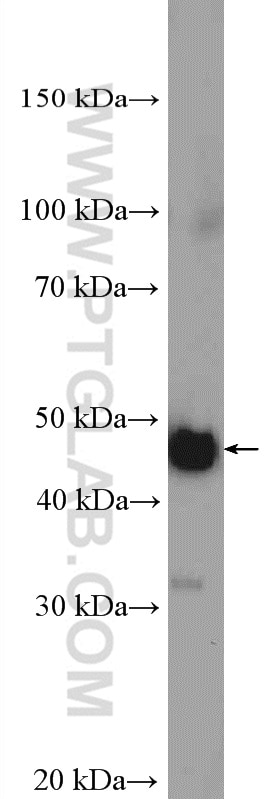 Western Blot (WB) analysis of mouse liver tissue using MTERFD1 Polyclonal antibody (23296-1-AP)