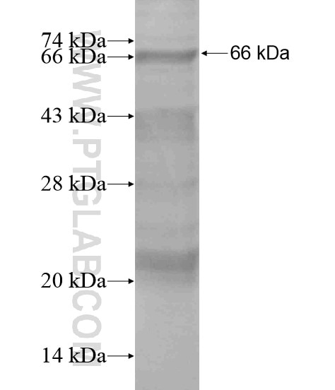 MTERFD1 fusion protein Ag19847 SDS-PAGE