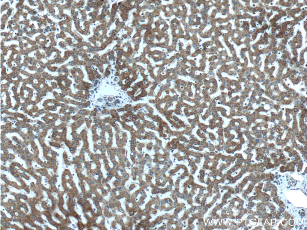 Immunohistochemistry (IHC) staining of human liver tissue using MTF1 Polyclonal antibody (25383-1-AP)