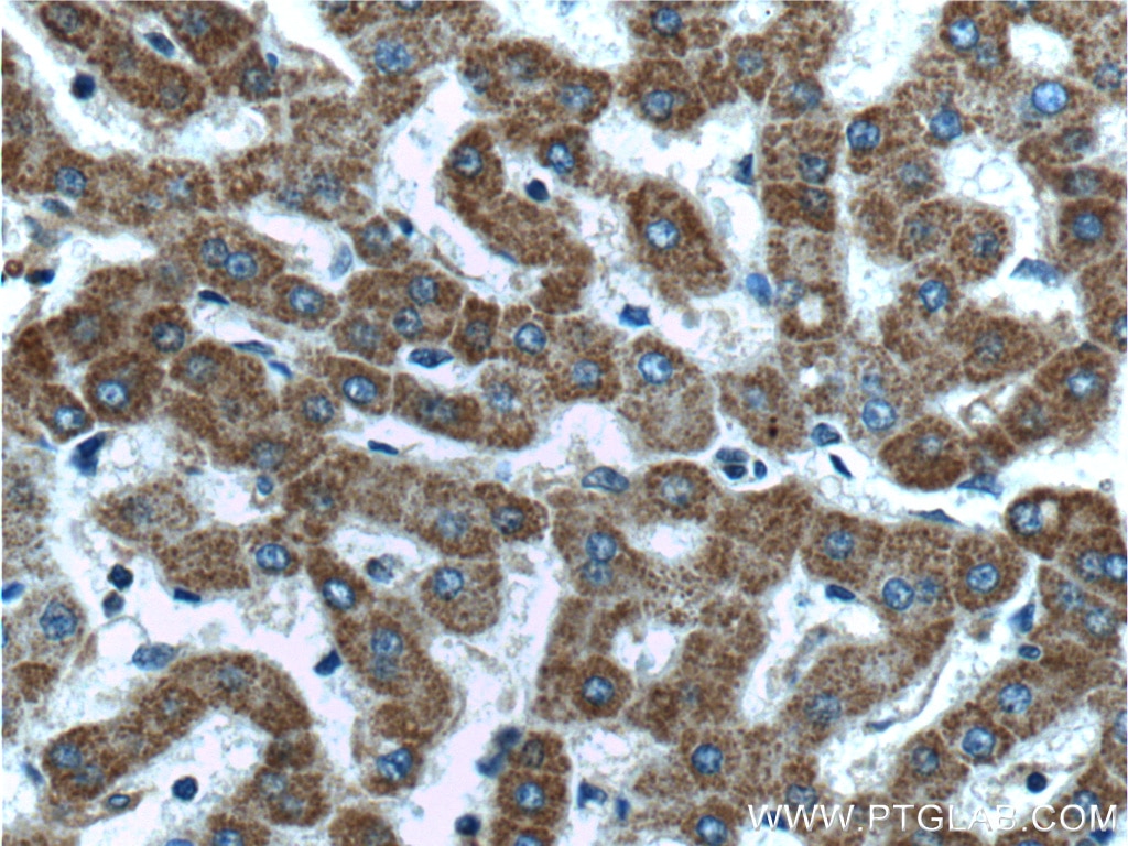 Immunohistochemistry (IHC) staining of human liver tissue using MTF1 Polyclonal antibody (25383-1-AP)