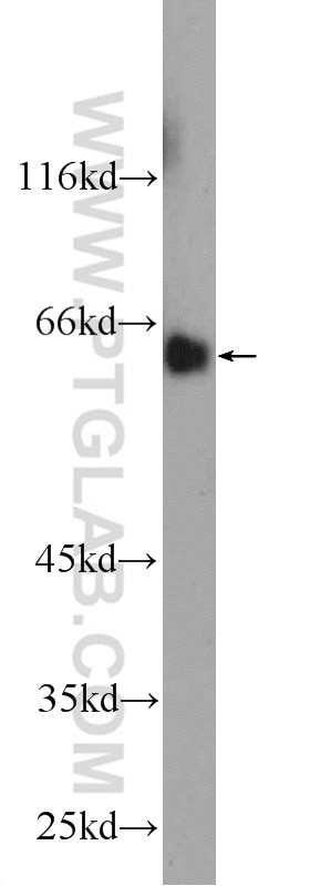 Western Blot (WB) analysis of mouse liver tissue using MTF1 Polyclonal antibody (25383-1-AP)