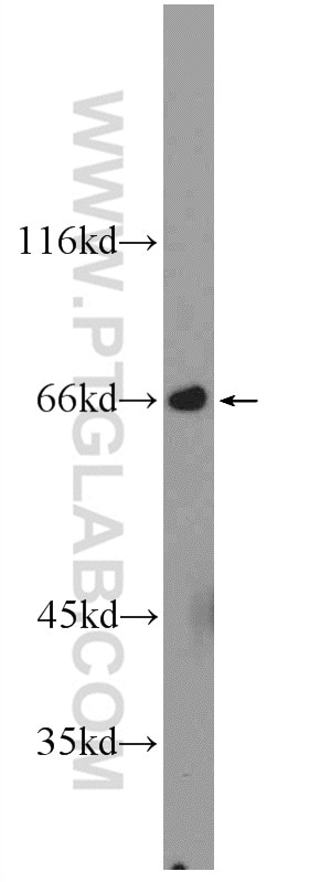 Western Blot (WB) analysis of mouse skeletal muscle tissue using MTF1 Polyclonal antibody (25383-1-AP)