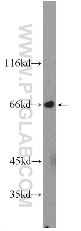 WB analysis of mouse skeletal muscle using 25383-1-AP