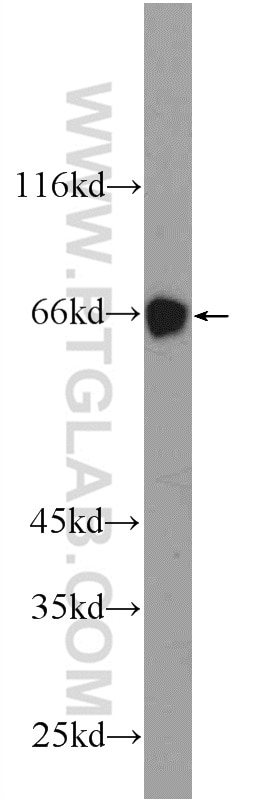 Western Blot (WB) analysis of mouse heart tissue using MTF1 Polyclonal antibody (25383-1-AP)