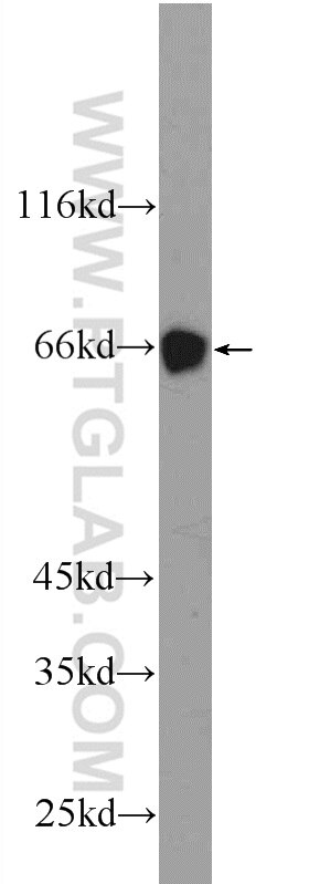 WB analysis of mouse heart using 25383-1-AP