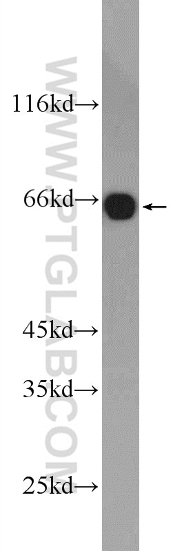 Western Blot (WB) analysis of mouse brain tissue using MTF1 Polyclonal antibody (25383-1-AP)