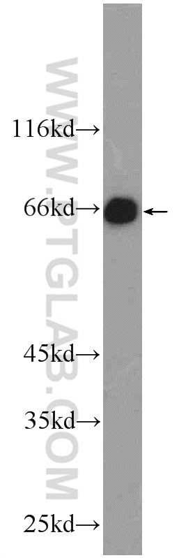 Western Blot (WB) analysis of Jurkat cells using MTF1 Polyclonal antibody (25383-1-AP)