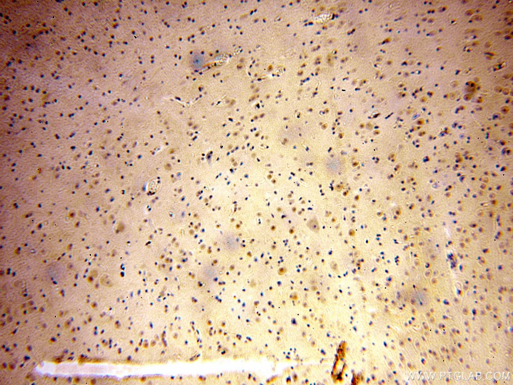 Immunohistochemistry (IHC) staining of human brain tissue using MTF2 Polyclonal antibody (16208-1-AP)