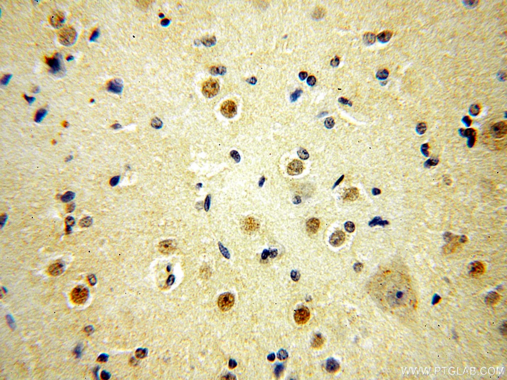 Immunohistochemistry (IHC) staining of human brain tissue using MTF2 Polyclonal antibody (16208-1-AP)