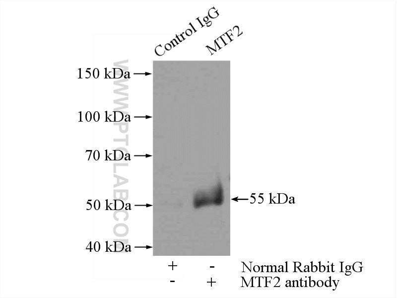 Immunoprecipitation (IP) experiment of mouse skeletal muscle tissue using MTF2 Polyclonal antibody (16208-1-AP)