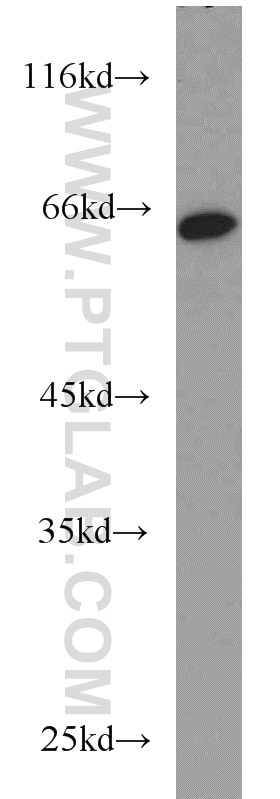 Western Blot (WB) analysis of HepG2 cells using MTF2 Polyclonal antibody (16208-1-AP)