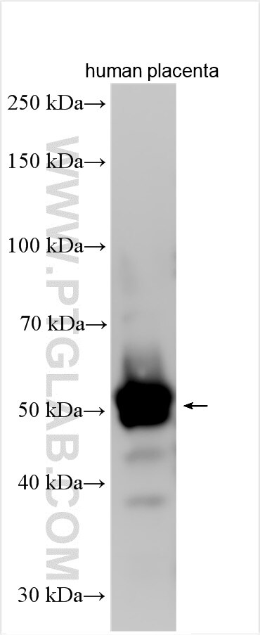 Western Blot (WB) analysis of various lysates using MTFMT Polyclonal antibody (25854-1-AP)