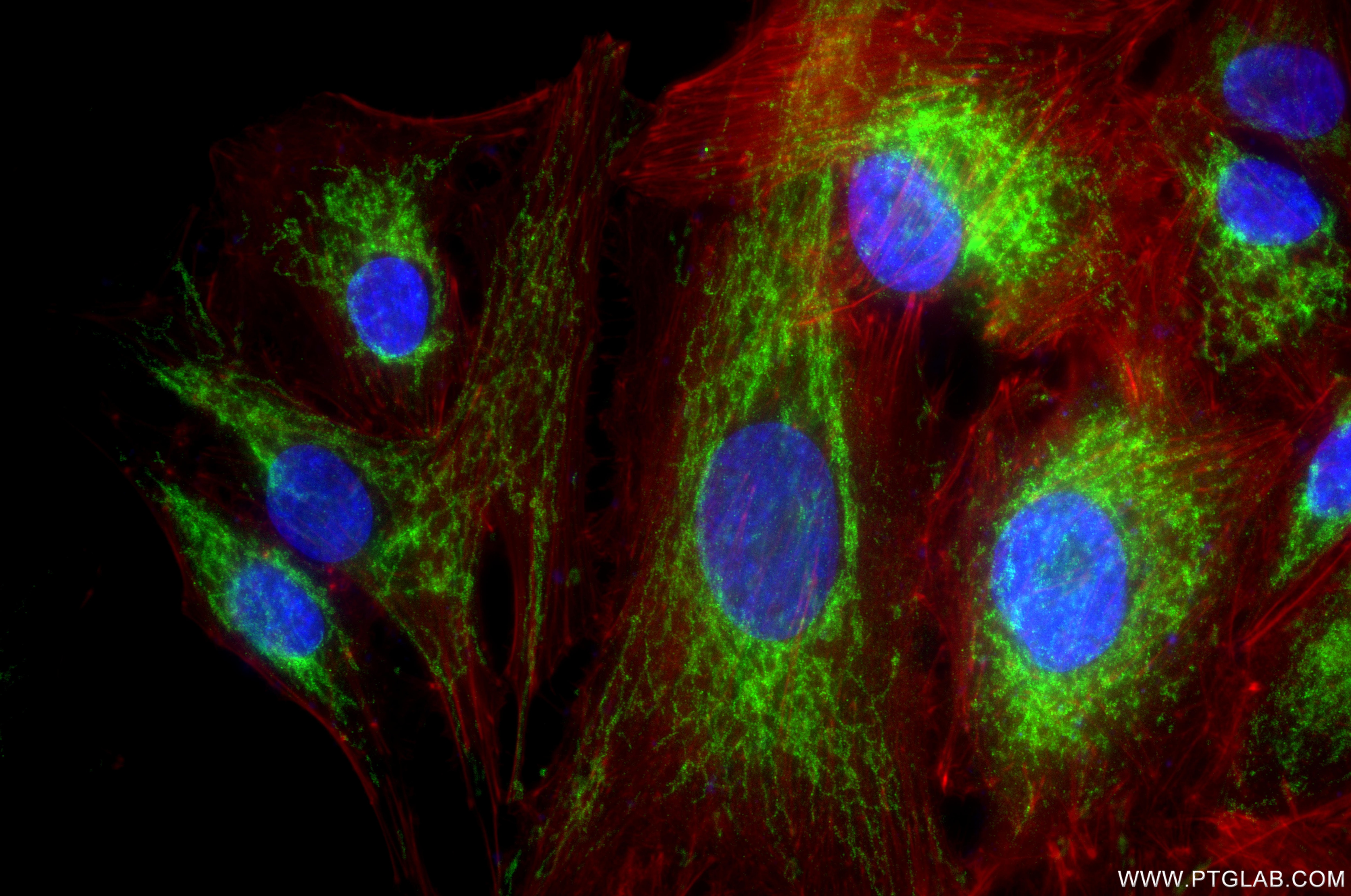 Immunofluorescent analysis of (4% PFA) fixed A549 cells using MTFR1 antibody (87130-1-RR, Clone: 252234C10 ) at dilution of 1:500 and CoraLite®488-Conjugated Goat Anti-Rabbit IgG(H+L) (SA00013-2), CL594-Phalloidin (red). Immunofluorescence (IF) / fluorescent staining of A549 cells using MTFR1 Recombinant monoclonal antibody (87130-1-RR)