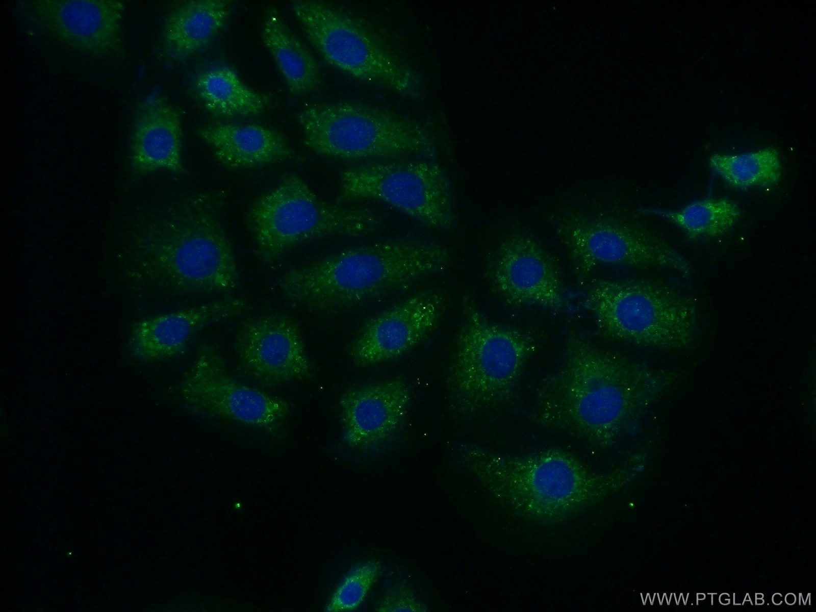 Immunofluorescence (IF) / fluorescent staining of SH-SY5Y cells using MTG1 Polyclonal antibody (13742-1-AP)