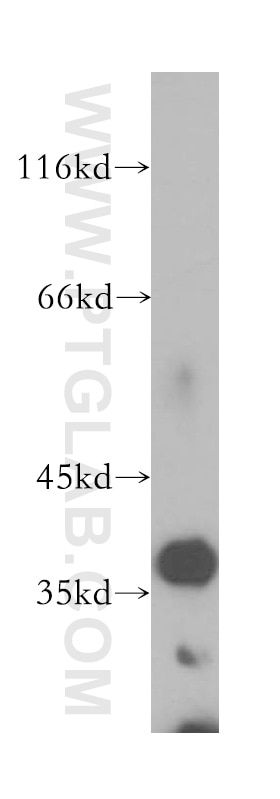 Western Blot (WB) analysis of human brain tissue using MTG1 Polyclonal antibody (13742-1-AP)