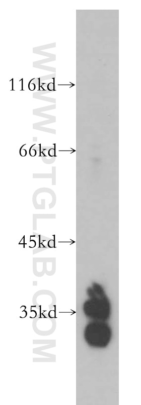 Western Blot (WB) analysis of human liver tissue using MTG1 Polyclonal antibody (13742-1-AP)