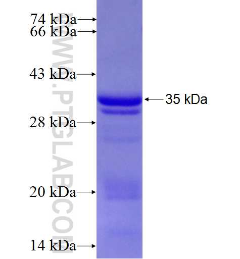 MTG1 fusion protein Ag5397 SDS-PAGE