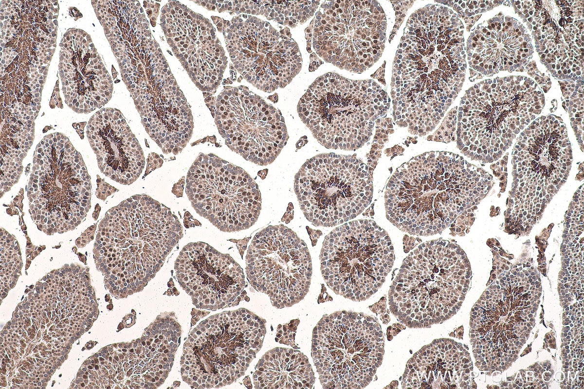 Immunohistochemistry (IHC) staining of mouse testis tissue using MTH1 Monoclonal antibody (67443-1-Ig)