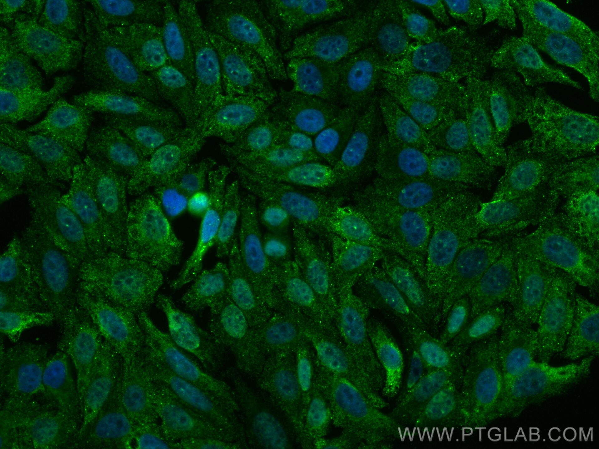 Immunofluorescence (IF) / fluorescent staining of HepG2 cells using CoraLite® Plus 488-conjugated MTH1 Monoclonal anti (CL488-67443)