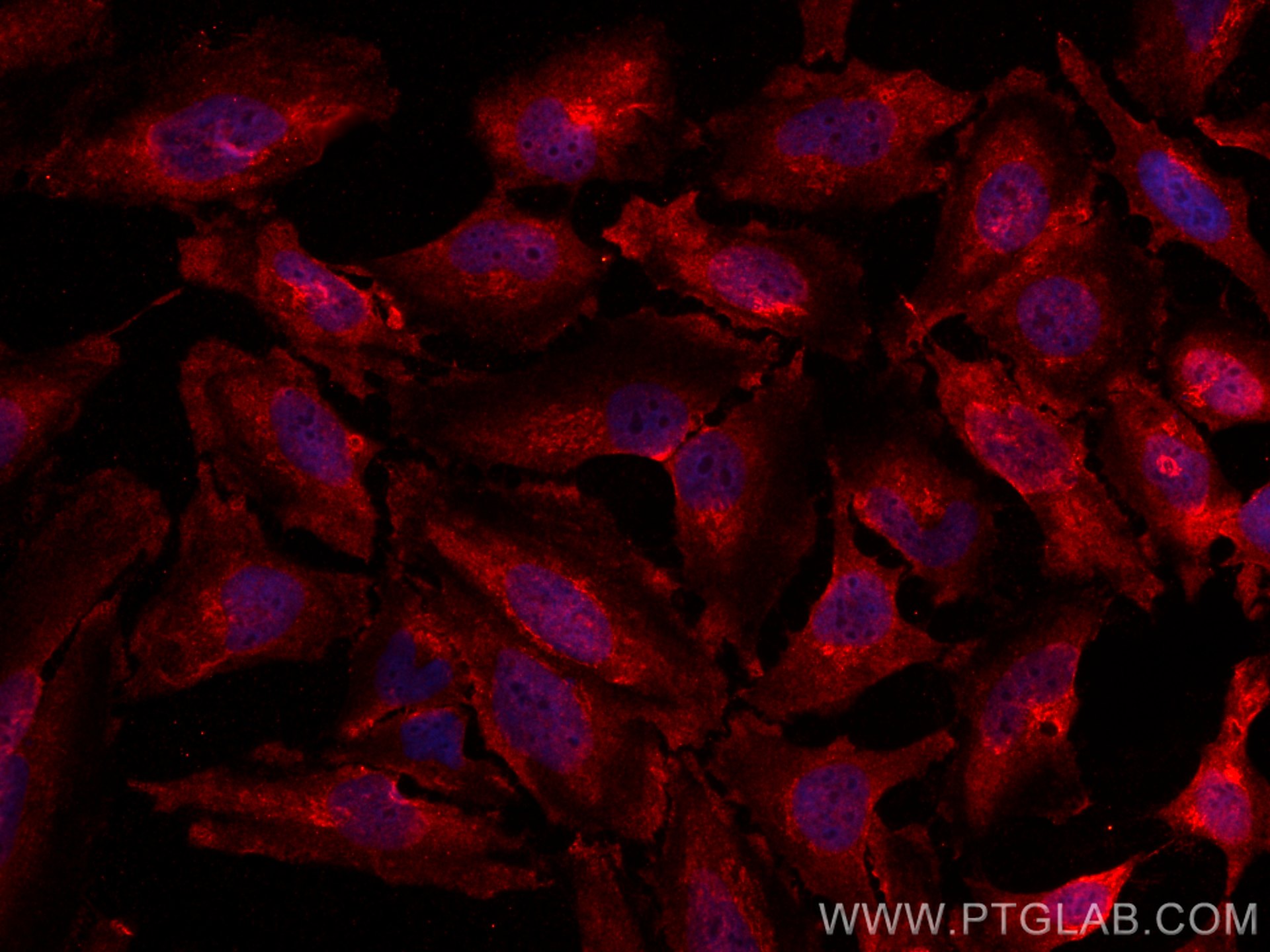 Immunofluorescence (IF) / fluorescent staining of HeLa cells using CoraLite®594-conjugated MTH1 Monoclonal antibody (CL594-67443)