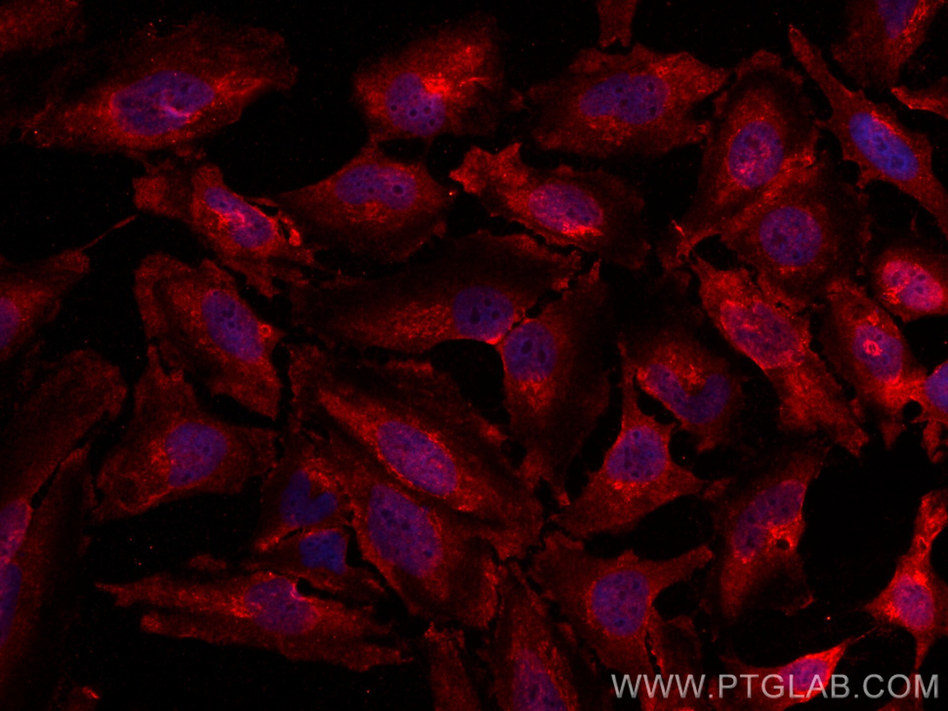 IF Staining of HeLa using CL594-67443